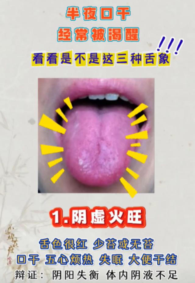 睡到半夜口干被渴醒？三种舌象对应不同体质
