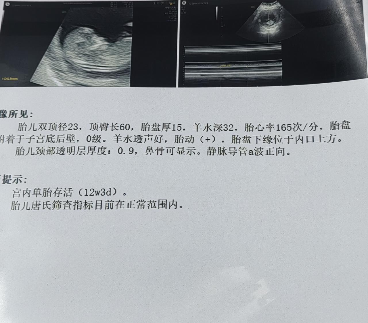 几家欢喜几家愁
今天小妞检查一切都好，准外婆笑得乐开花，今天铁路12306通知1