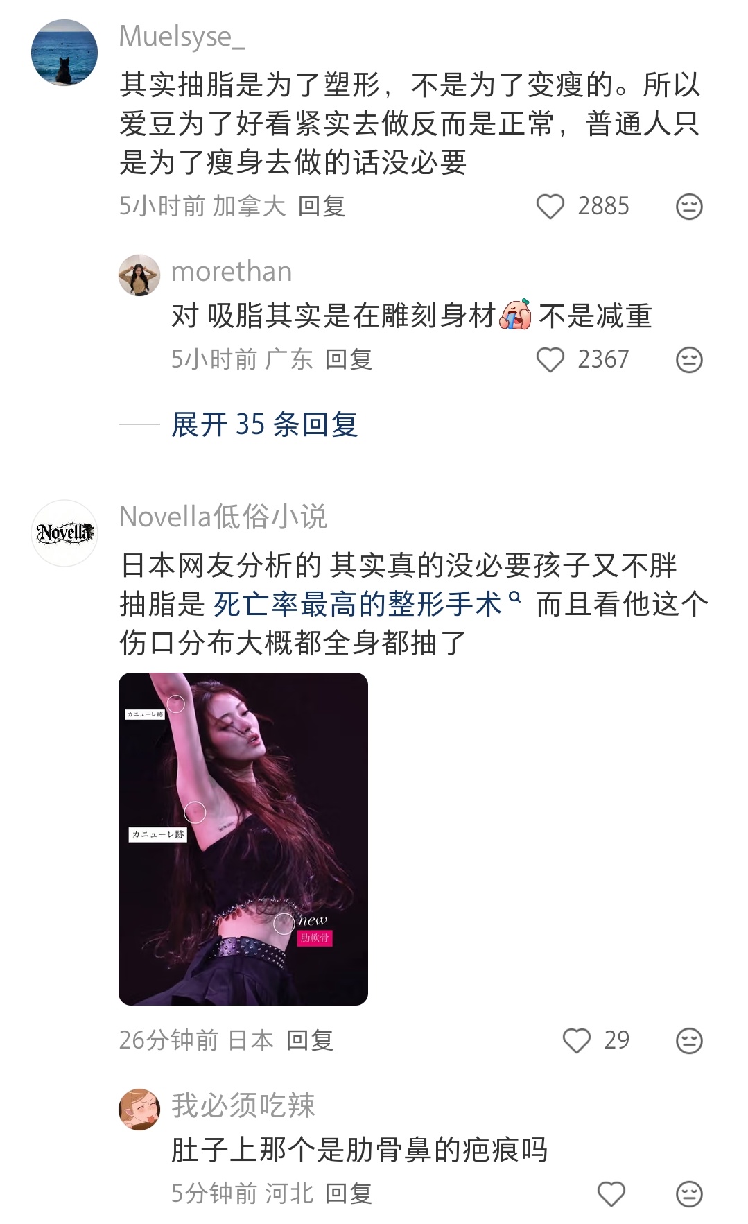 抽脂？
