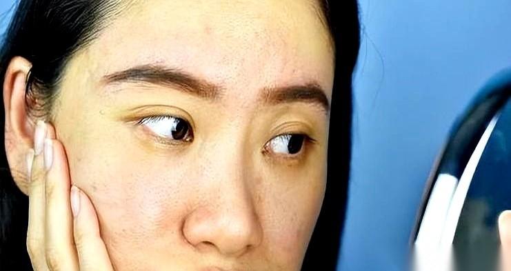 你有没有死死盯过镜子里的自己？
别总怪熬夜，血糖高了，脸是第一个“叛变”的。
不