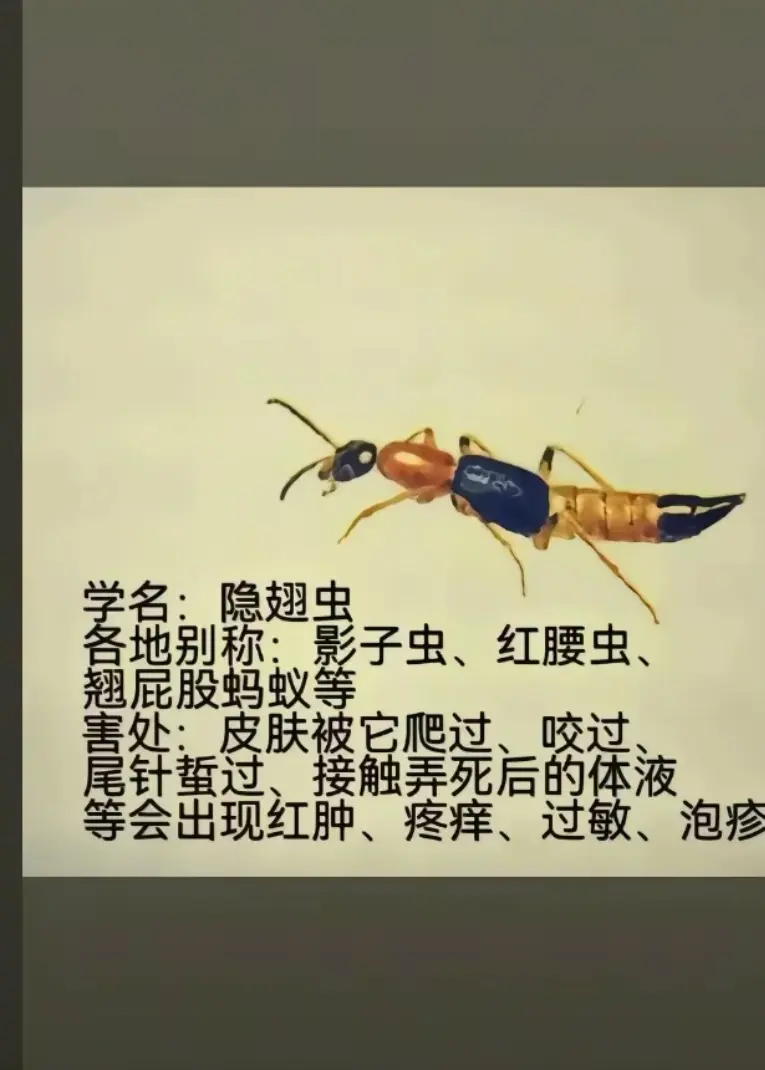 隐翅虫的危害