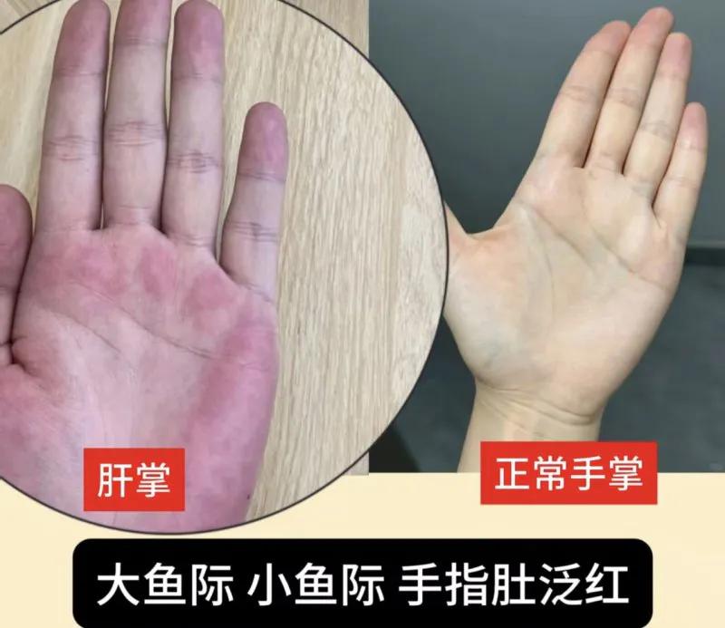 健康无小事，身体才是本钱
 很多时候我们只关注外在风光，却忽略了身体发出的细微信