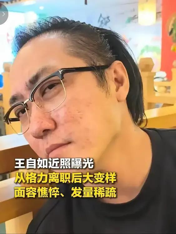 惊诧！仅仅才1年光景，37岁王自如怎么就从“小鲜肉”变成“老腊肉”啦！
大概一年