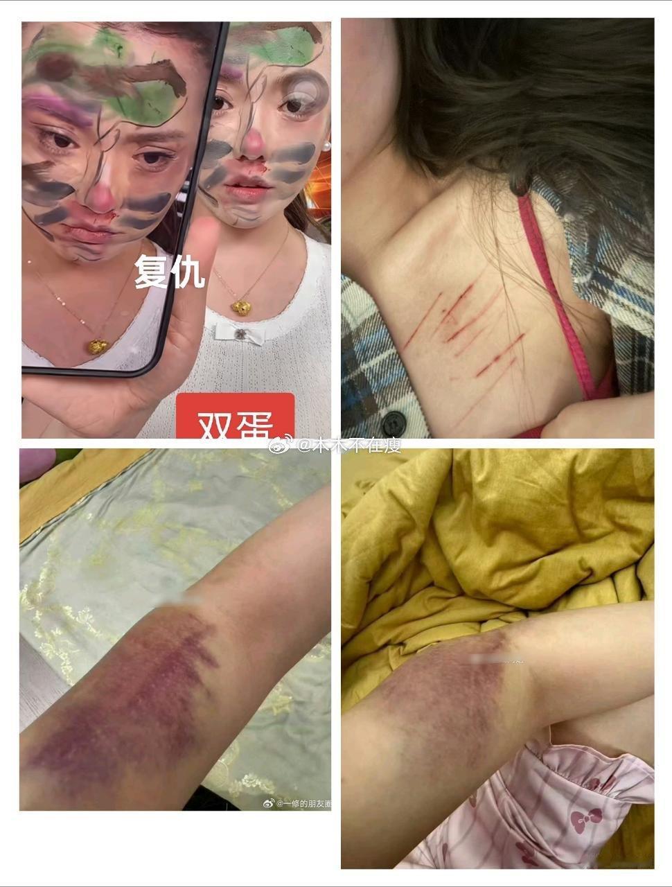 是谁把辛巴的爱徒蛋蛋揍成这样