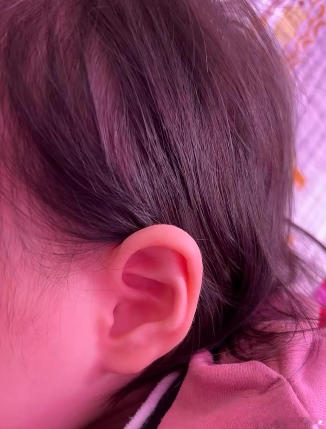 老人为啥喜欢把鬓角往耳朵后面塞 ​​​