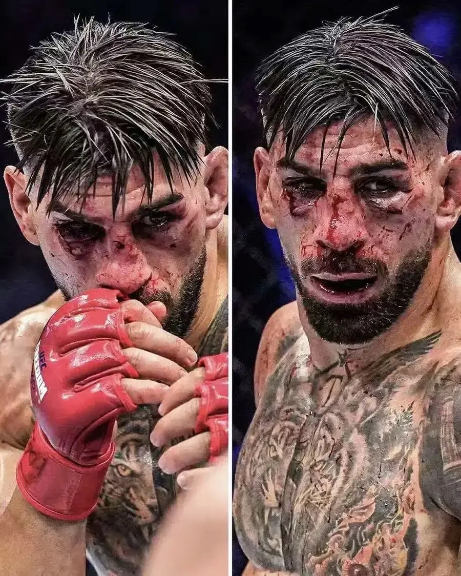 UFC白宫战让我们见识到了双冠王的陨落，上救护车的时候伤心落泪，一切都...