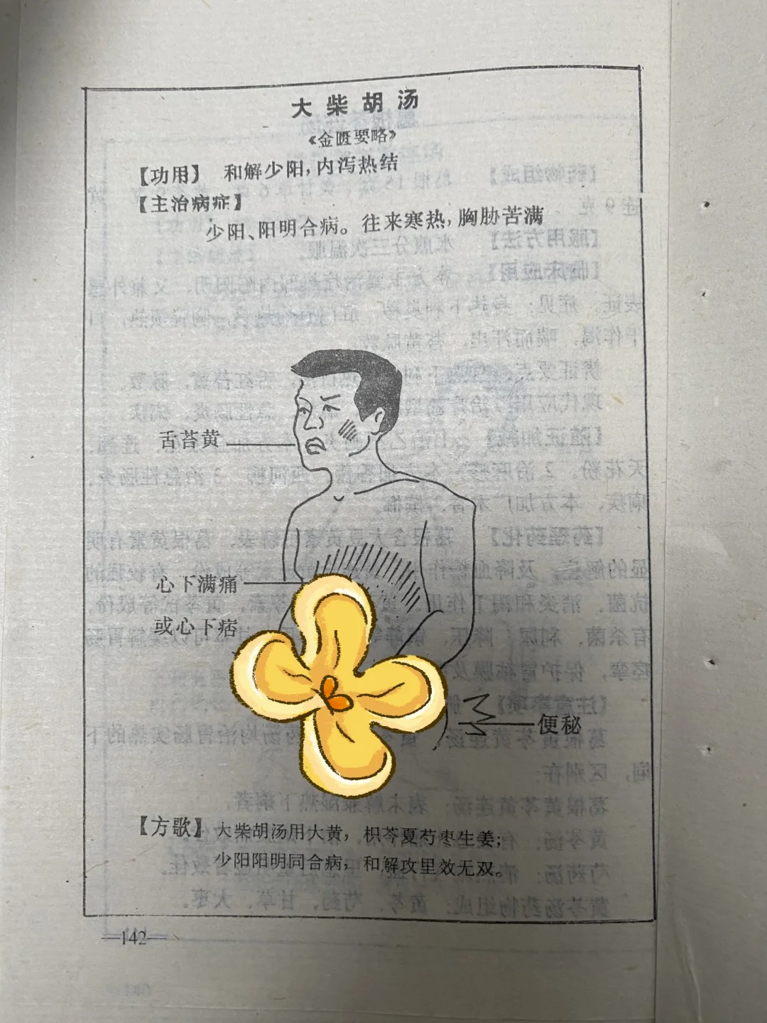 原来老书真有东西，大柴胡汤原来是这么用的