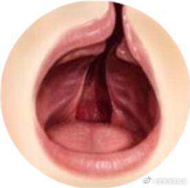 #得了唇腭裂有什么影响##健闻登顶计划# 如何预防唇腭裂？妈妈在怀孕前和怀孕中都