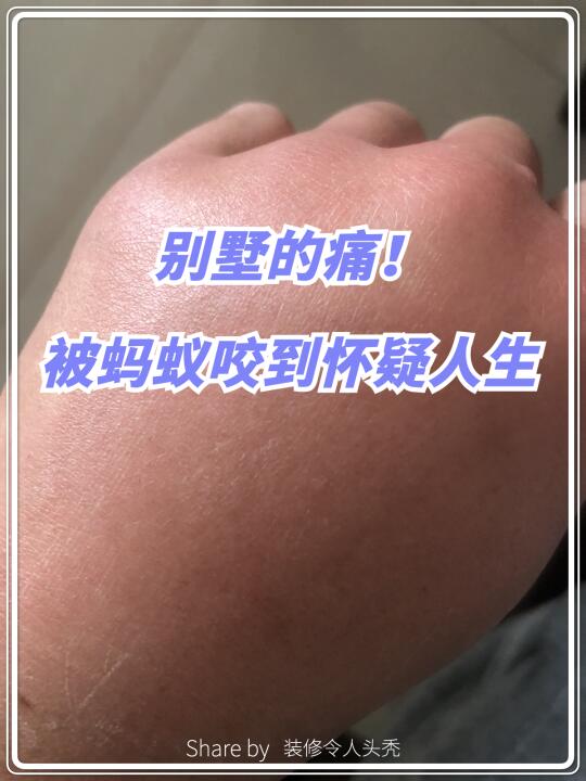 别墅的痛┃入住3个月，被蚂蚁咬了4次