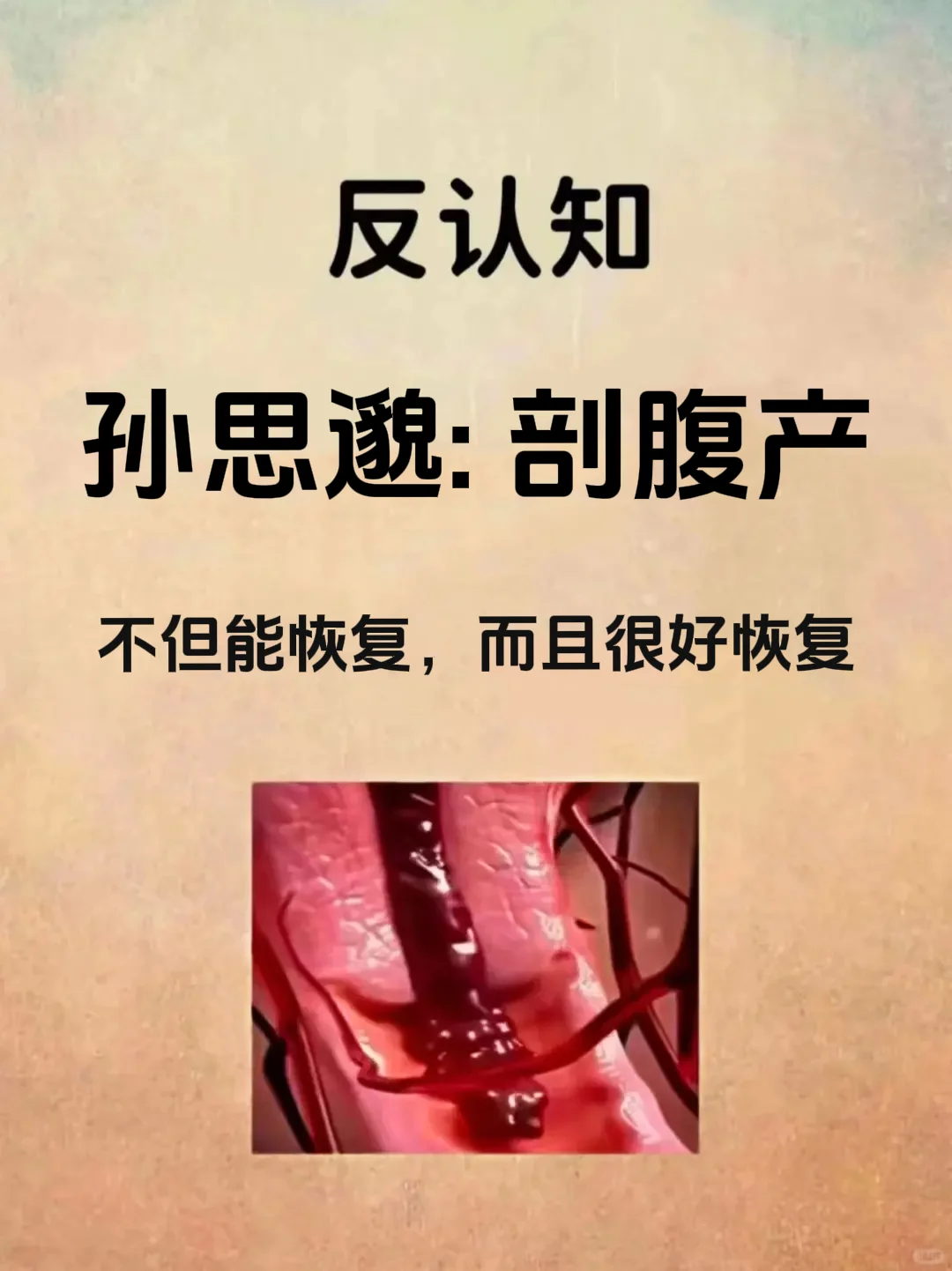 孙思邈：剖腹产不但能恢复，而且还很好恢复