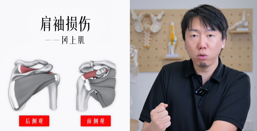 肩周炎vs肩袖损伤  穿脱衣服、抬起胳膊，肩膀出现疼痛、弹响，究竟是肩周炎还是肩