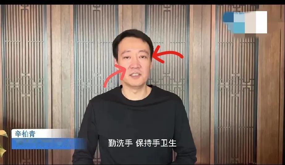辛柏青一定太痛苦了，双眼通红还肿了！朱媛媛去世前17天，还在为“五一”拍摄卫生宣