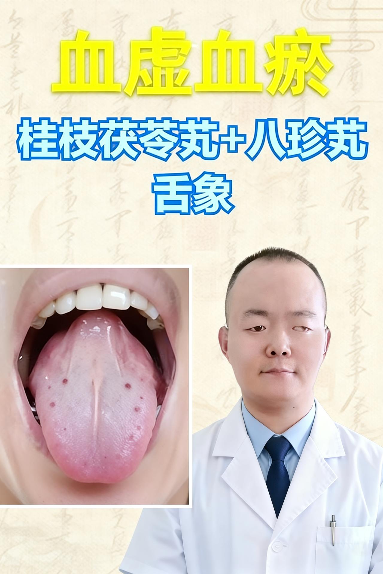 又虚又堵？两味丸药搭着吃，补好血虚、化掉血瘀！
大家好，我是中医陈大夫！
很多人