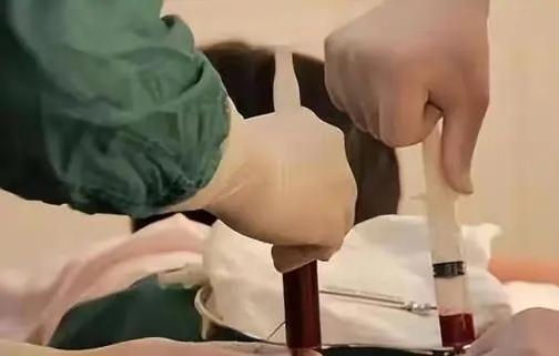 究竟是谁的过错？2011年，云南女大学生捐髓救人，患者在康复后却大骂捐赠者：她就