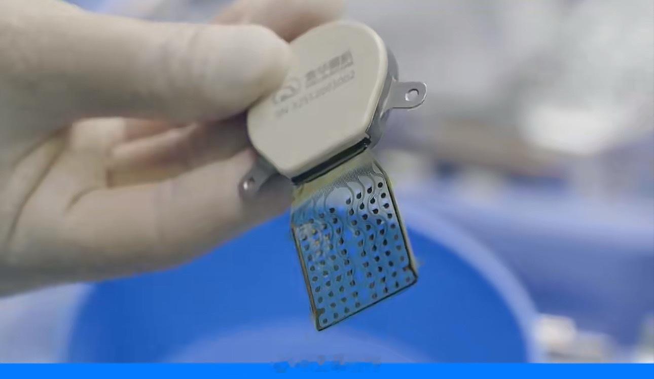 安徽首例半侵入式脑机接口手术成功远在金华却看到了家乡的发展，半侵入式脑机接口手术