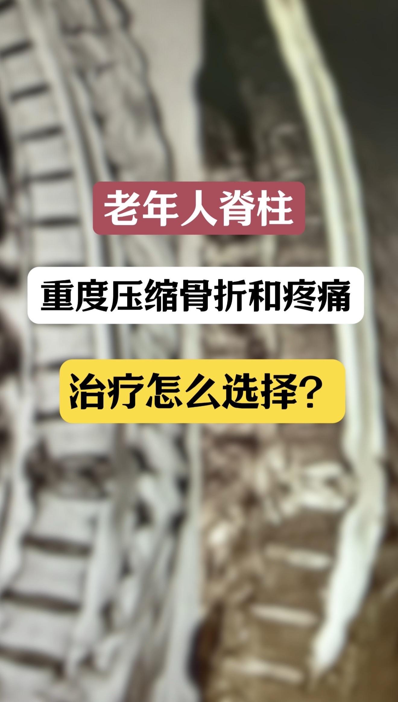 80多岁女性，胸11骨折后3月，腰痛难忍，不能下床活动，日常只能坐轮椅...