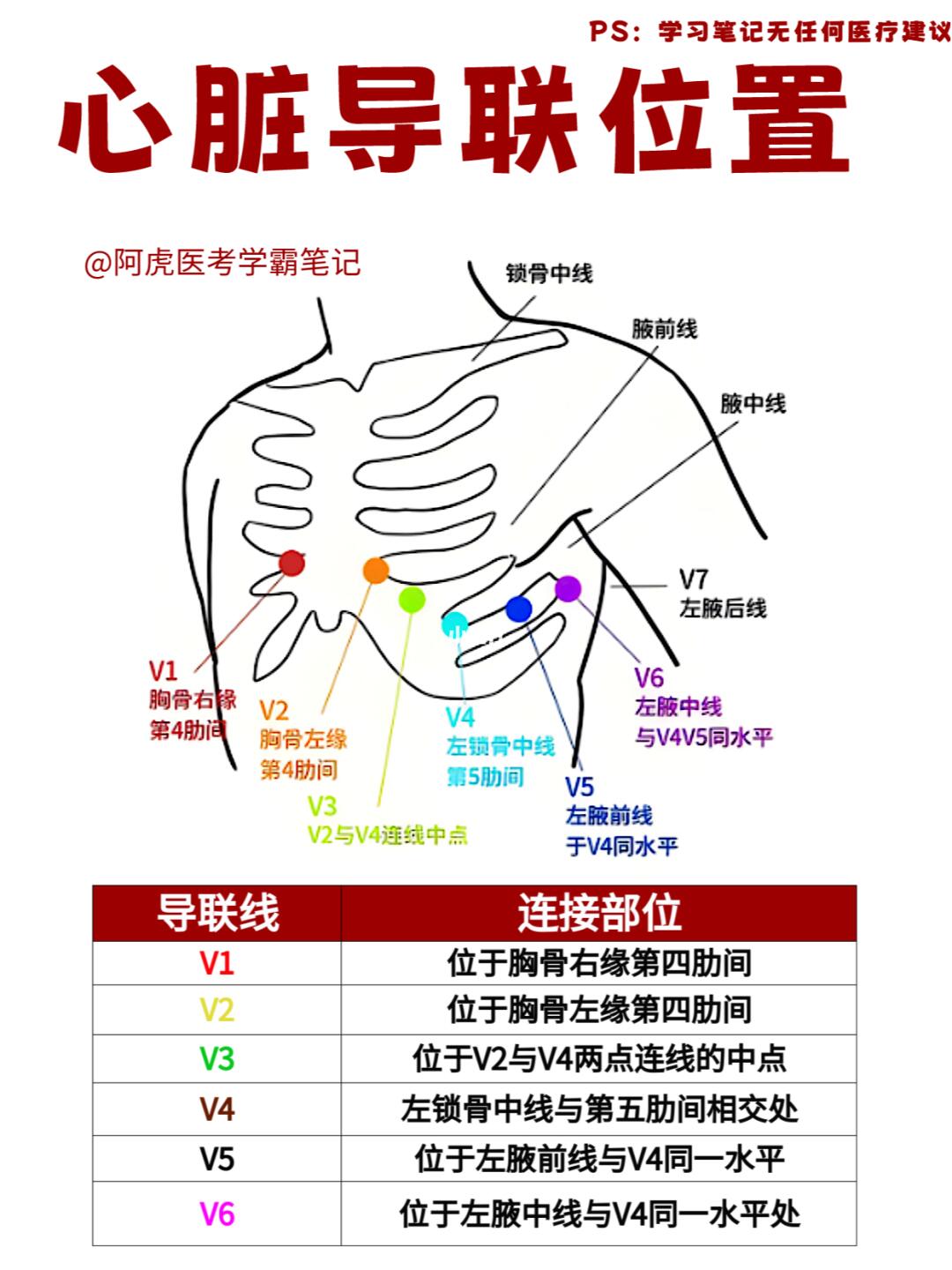 阿虎医考学霸笔记📒：心脏导联位置👆