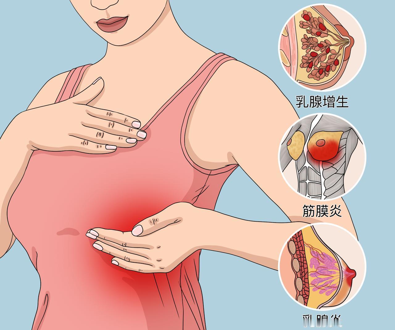 #健康真探社#【女人“伤害乳房”的4大行为，很多人都爱做！】谷歌曾发布一张全球胸