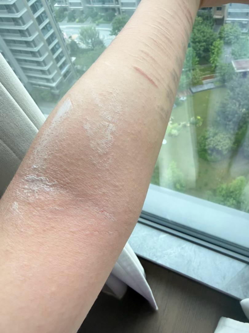 美白身体乳固然好，可是酸➕美白➕磨砂膏很伤皮肤……痒得我晚上一直挠，只能涂修复的