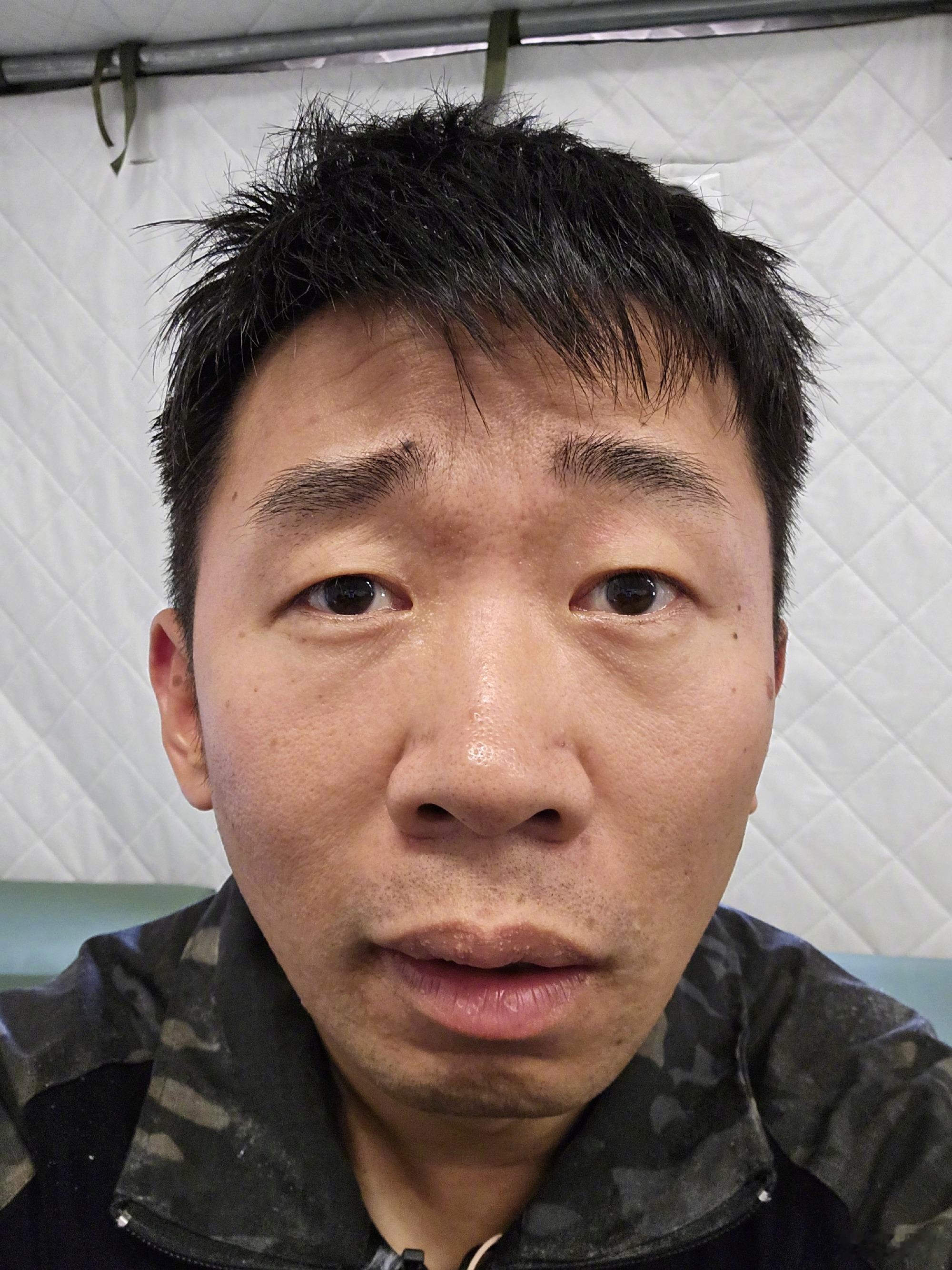 #娱乐[超话]##杨迪没洗头##杨迪头发好油# 杨迪没洗头，头发好油！ 得早点去