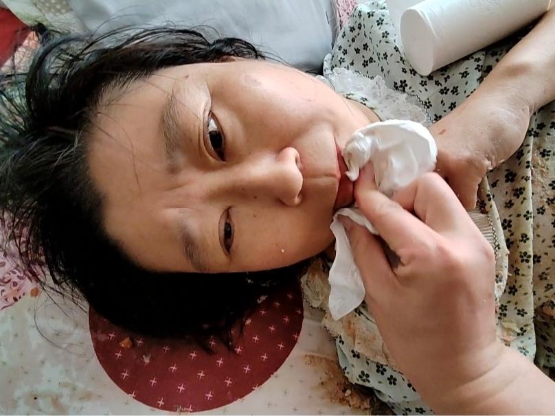姐姐突发严重低血糖变成了植物状态，眼睛发直，没有任何反应，不断的呕吐，身上和床上