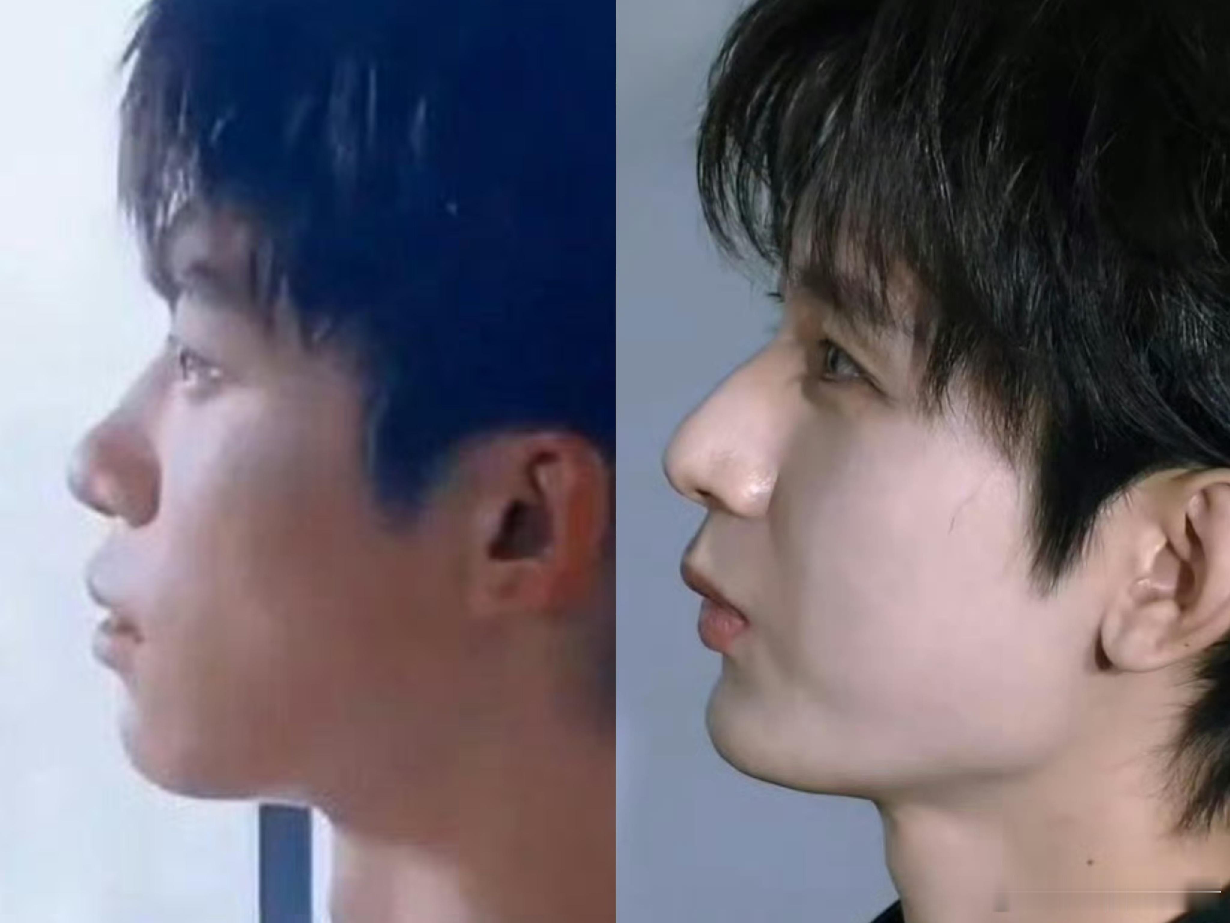 粉丝眼中的绝顶帅哥 