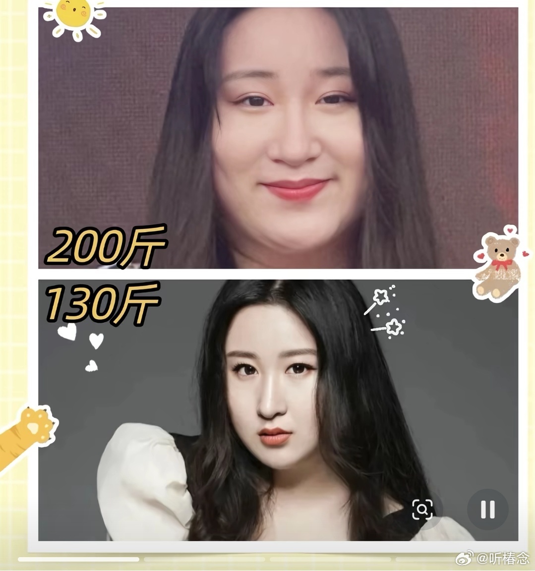 锤娜丽莎回应打针减肥质疑不是，别人就不能是自己减肥成功的吗，说人家打针，莎莎一直
