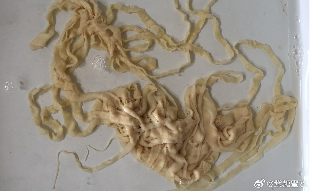 不要生吃或半生吃猪肉牛肉牛带绦虫病是由寄生于人体肠道中的牛带绦虫所引起的一种寄生