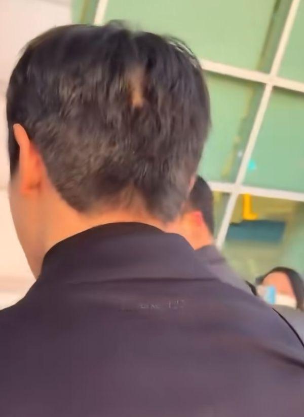 李泰容怎么斑秃了 这状态还能和罗渽民竞争四颜一吗？