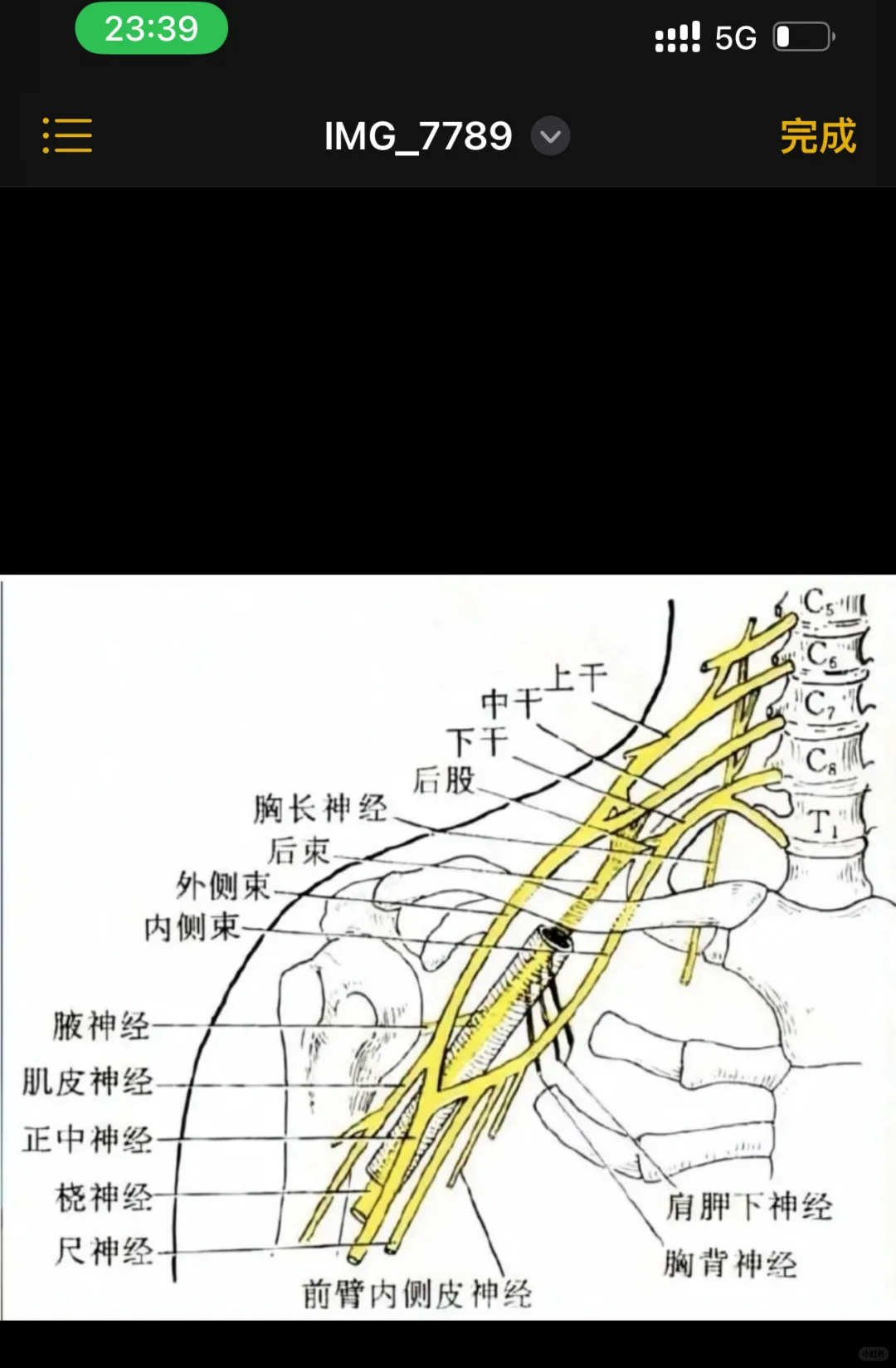 2分钟快速搞定臂丛神经