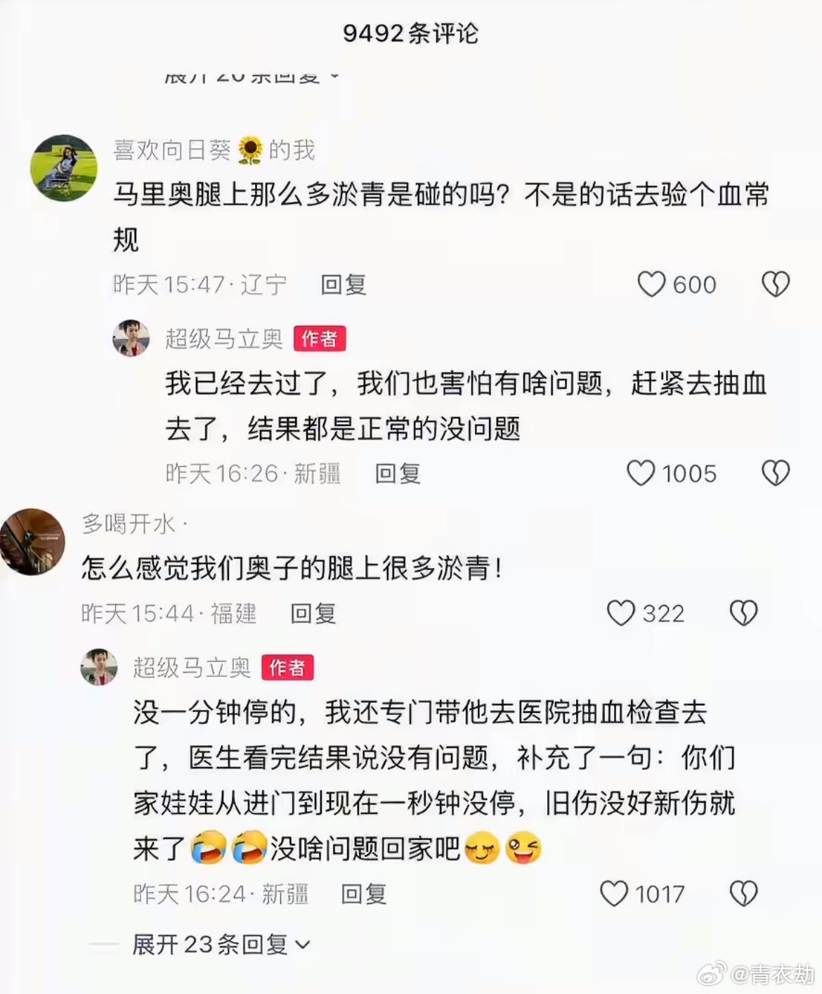 马立奥腿上好多淤青这么大的男娃身上没点磕磕碰碰的才奇怪吧？根本管不住，没一秒闲着