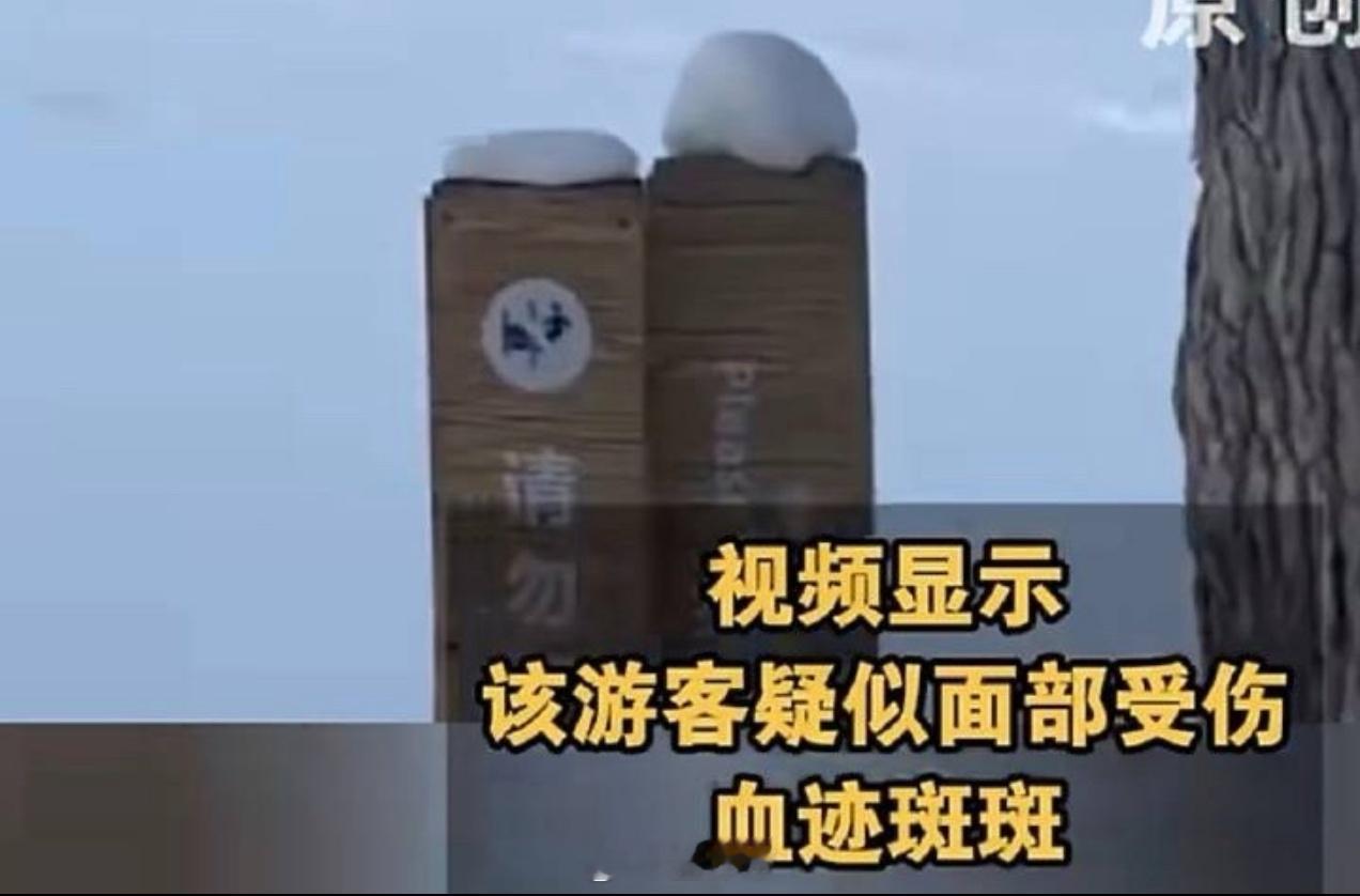 被雪豹咬伤女游客否认跟雪豹拍照没跟雪豹合影我是信的但是你就说你靠没靠近吧对野生动