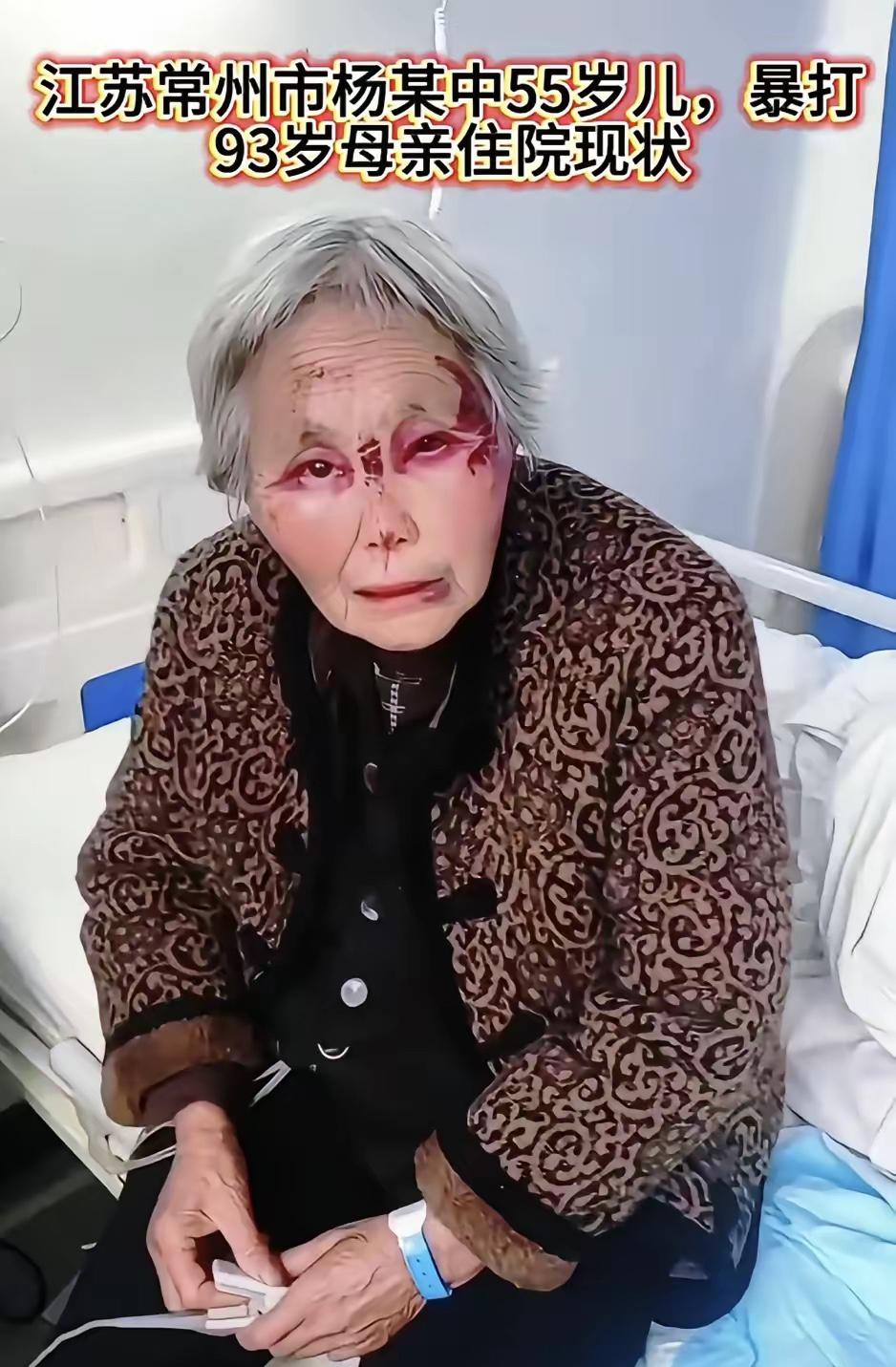 女儿四个，
儿子一个，
有儿有女凑成个好字！
常州老母亲遭亲儿子暴打住院这事儿真