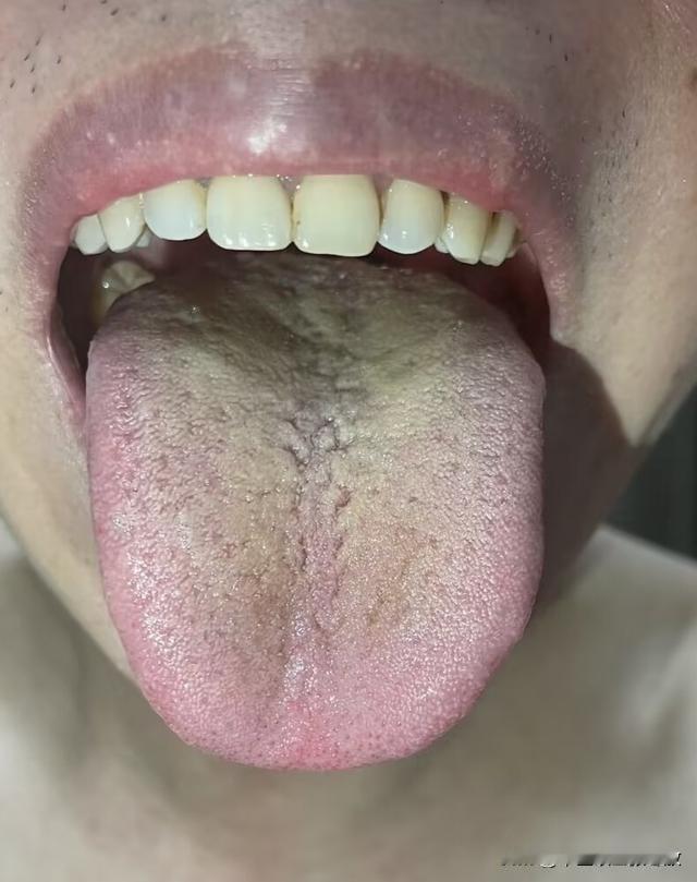 这小家伙才26，刚结完婚不到一年，他就软趴趴的[流泪][流泪][流泪]
之前感觉