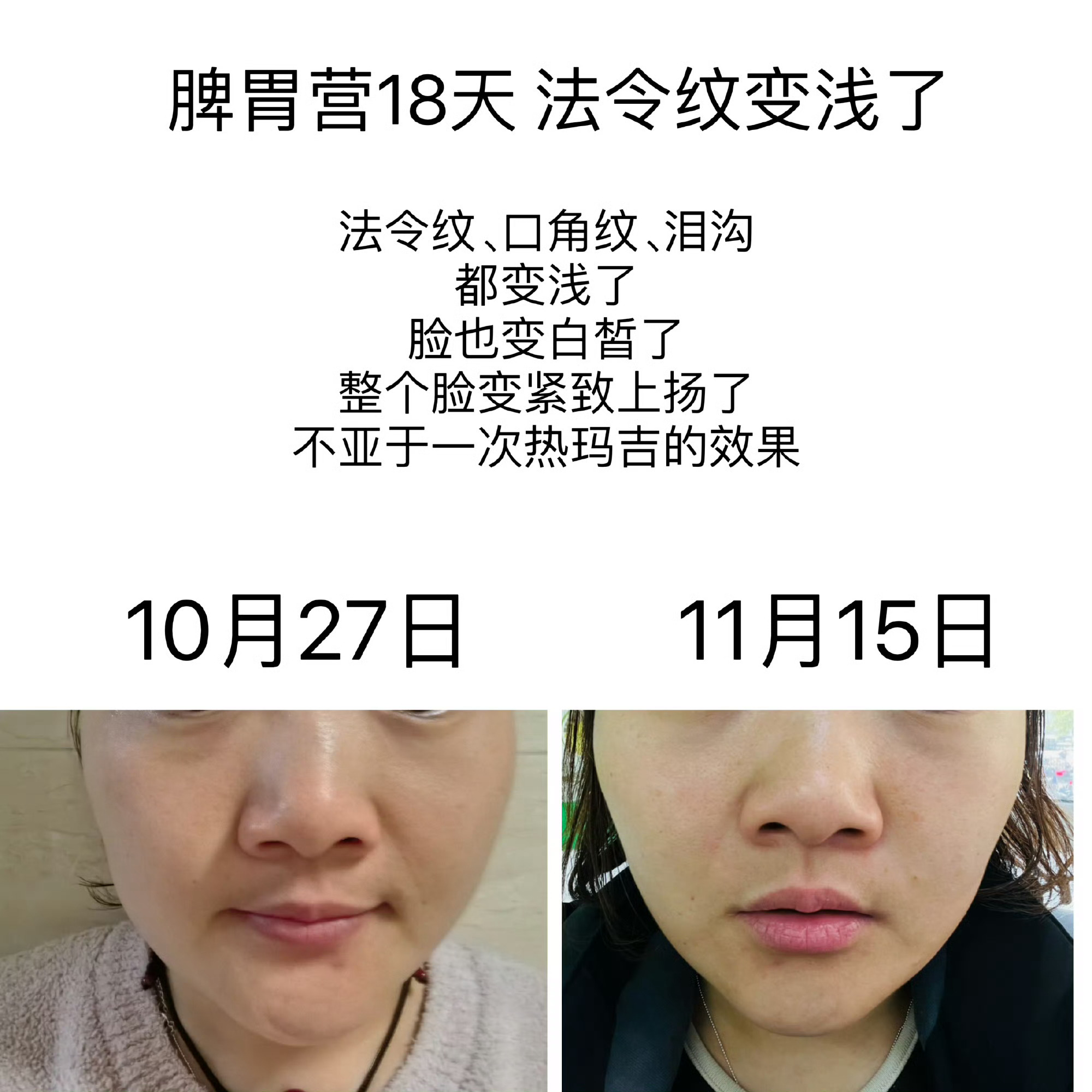 为什么脾胃好，脸上皱纹会少？参加完第1期脾胃营后，我发现，我的脸更加紧致、上提了