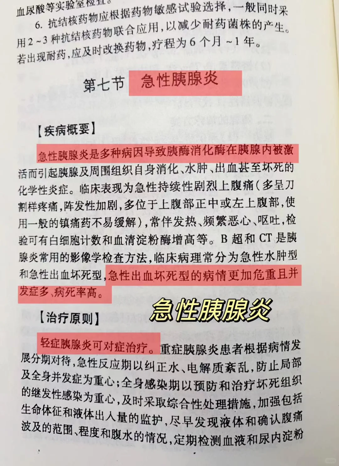 规培｜急性胰腺炎