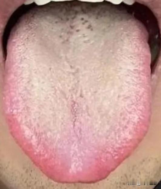 功能差，欲望强，你可能是肝脏出了问题，先去补肾没效果

患者主诉：那个时间短，功