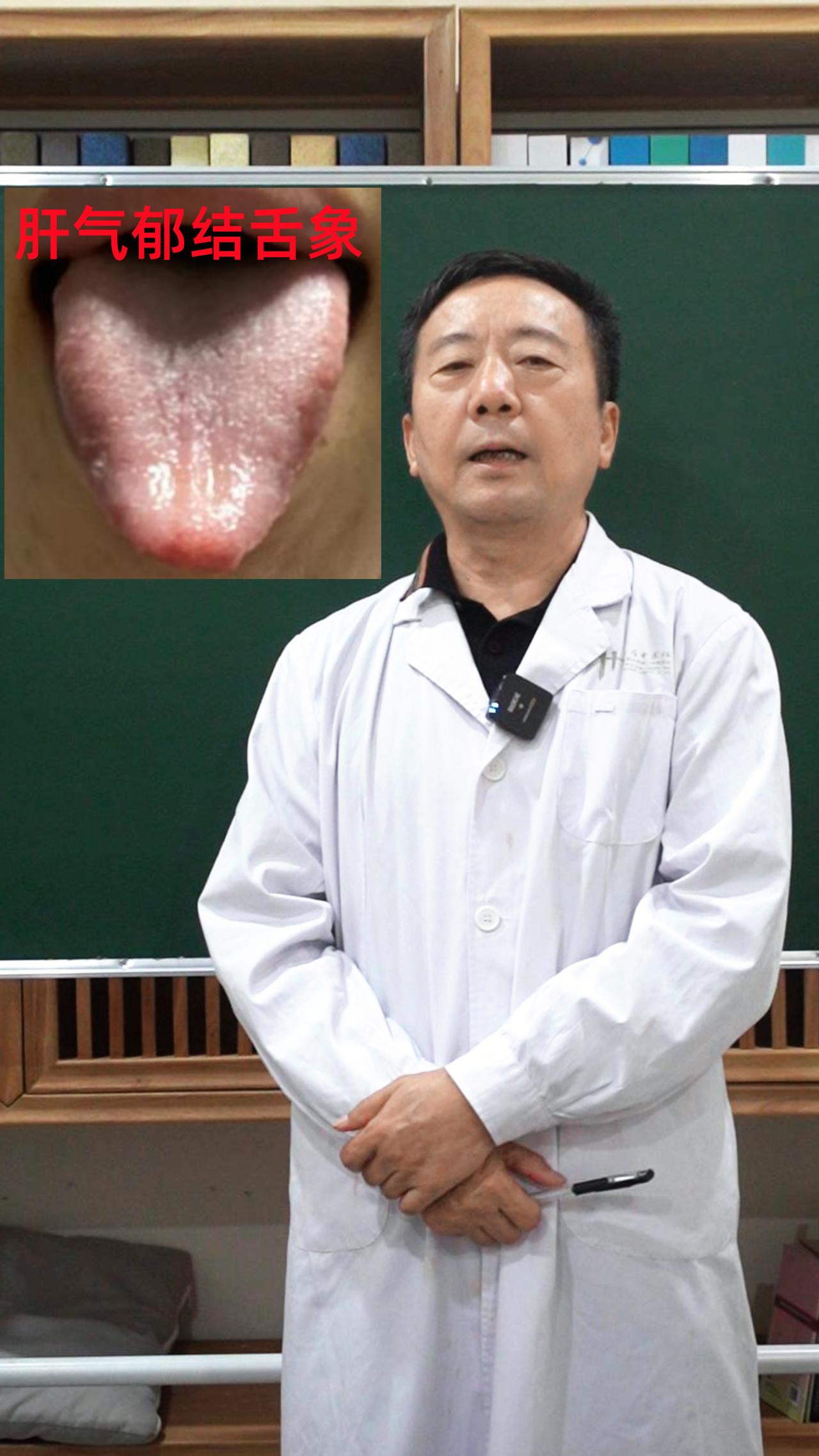 注意！注意！注意！你拍舌象，我来分析。
朋友们，大家好啊，我是中医张佩江，今天是