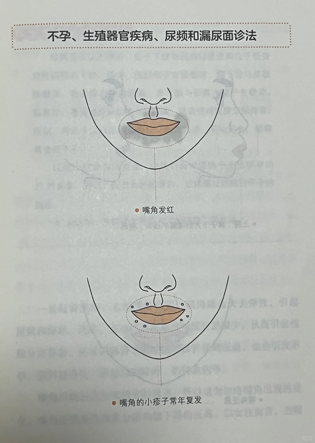 不孕、生殖器官疾病、尿频、漏尿面诊法及疗护