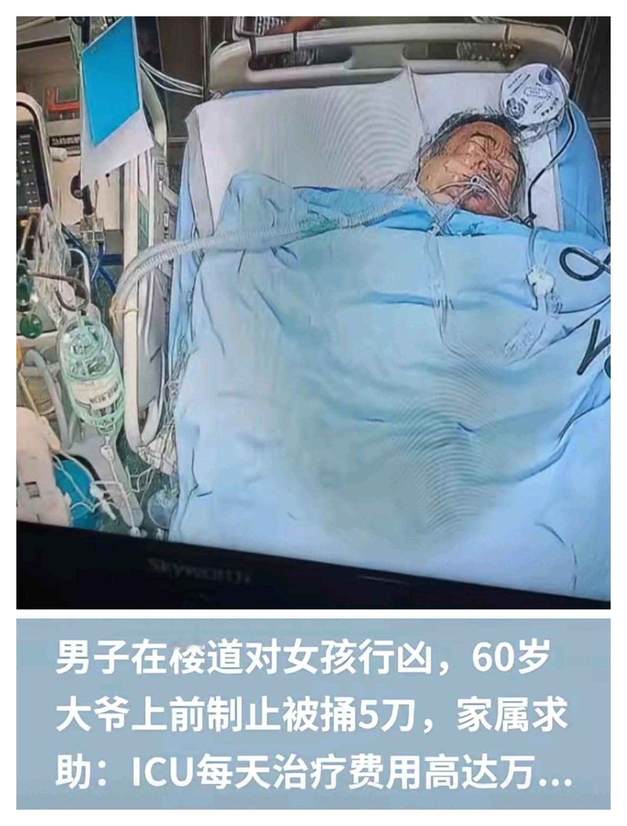 重庆60岁大爷见义勇为被连捅5刀！ICU日费1万，普通家庭快扛不住了
 
谁看了