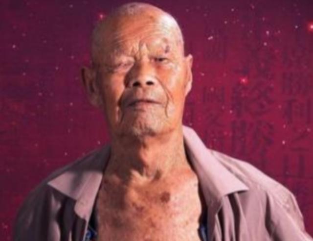 1956年，35岁农民咳嗽10年，竟拒绝就医，一天，他突然用力咳嗽，“哇”的一声