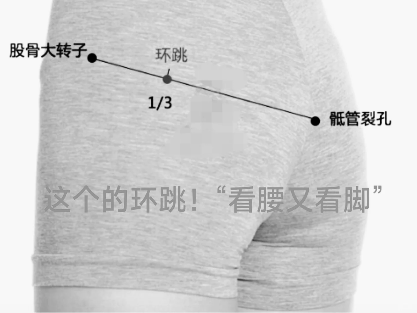 这个的环跳穴“官腰又官脚” ，一身轻松