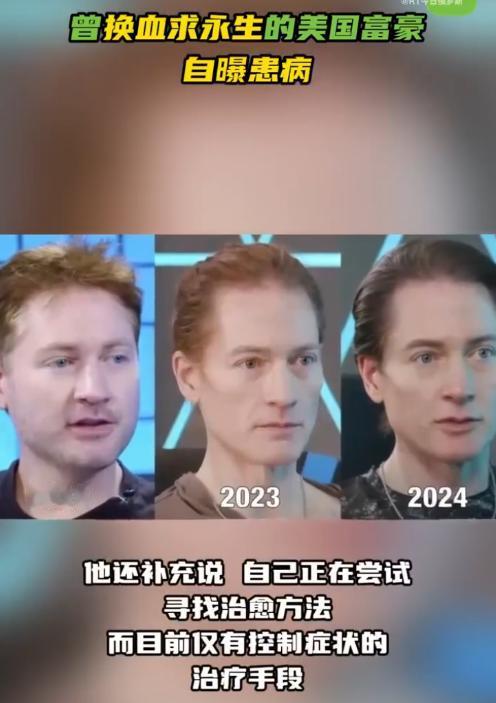 砸200万美元换血抗衰，48岁富豪的胃却开始“自我吞噬”
7月6日，美国亿万富翁