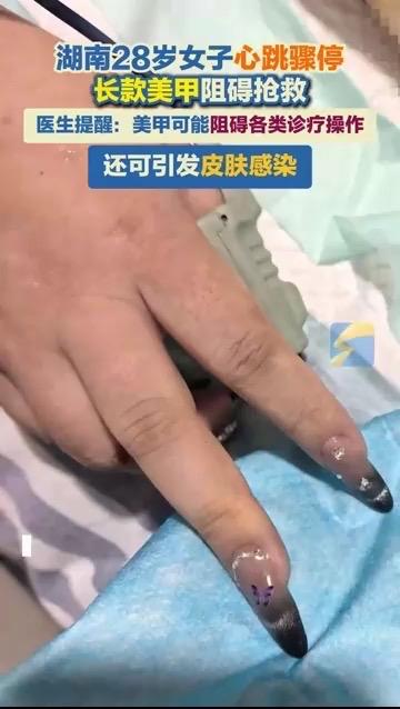 救命关头，美甲竟成“夺命障碍”！28岁女子心脏骤停，真相让所有女生警醒

28岁
