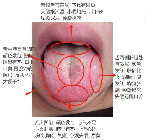 舌诊分析图解来了！潘医生最近的医案分享，全给大家发出来，一定要好好学，认真的看，