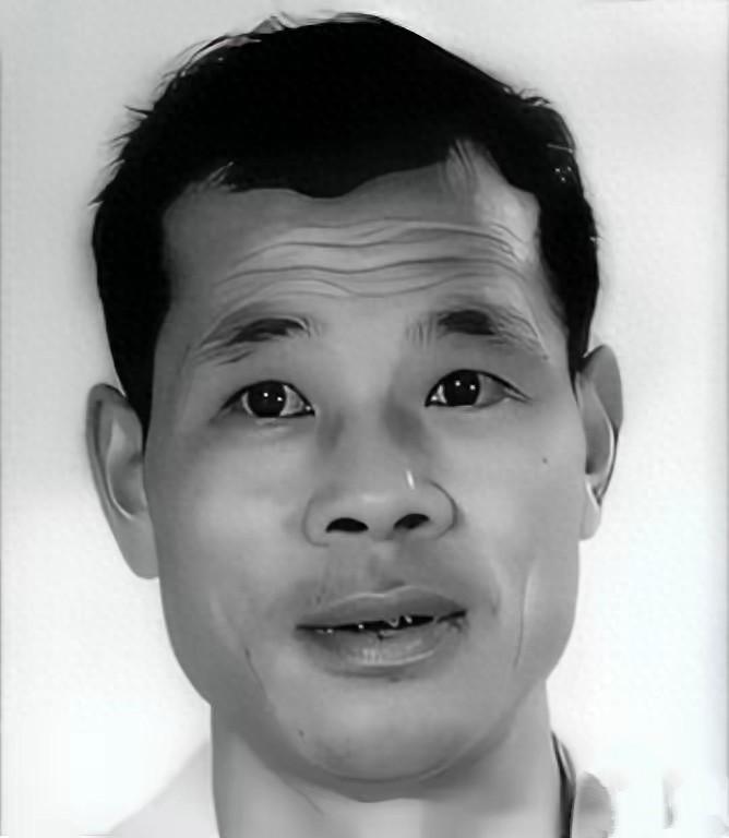 1982年6月16日，西安某医院给一位四十多岁男人做遗体解剖。医生发现他全身上下