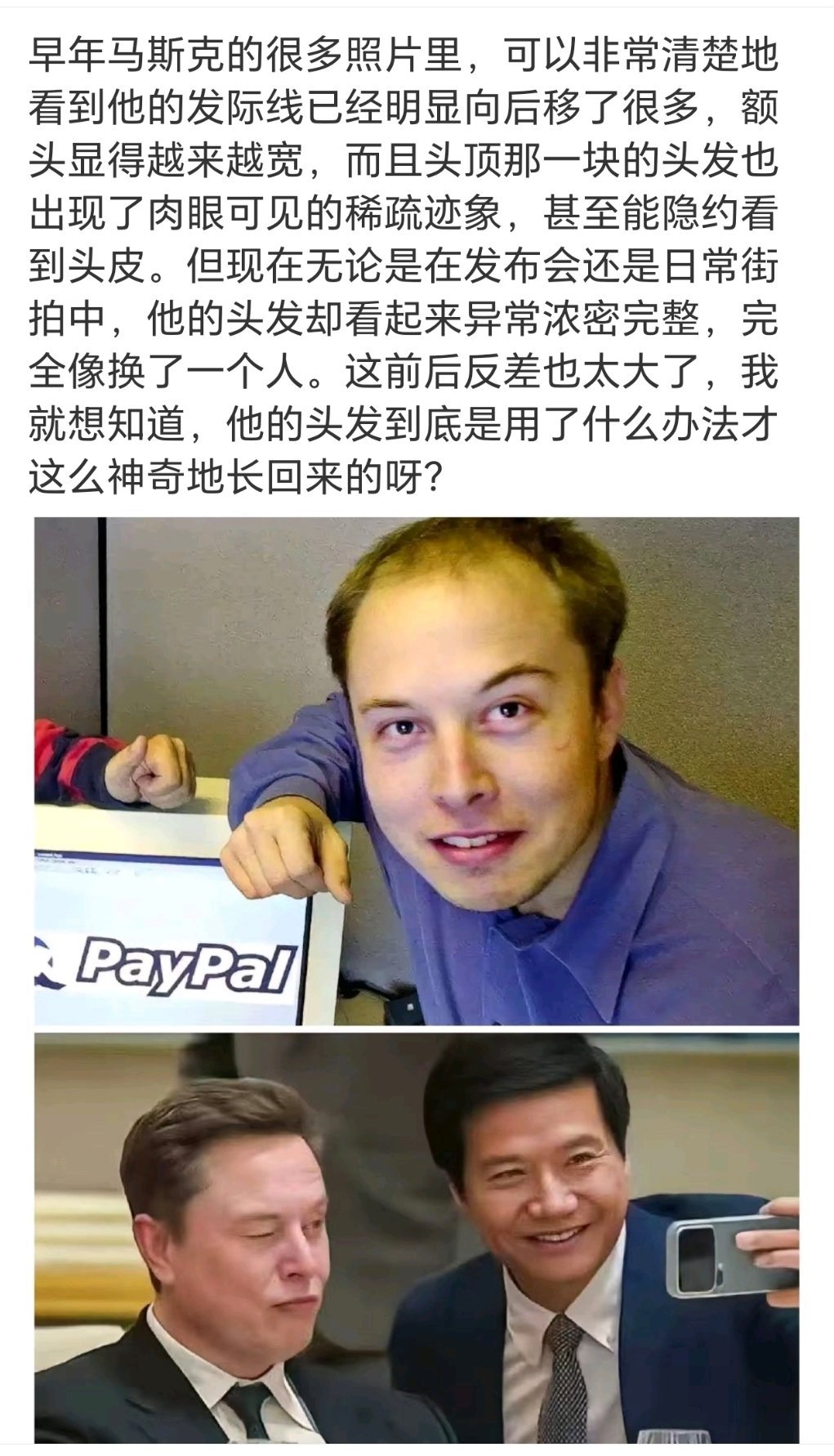 植发效果这么好吗？而且我发现他好像比同龄的欧美人长得显年轻，我没想到他50岁了 