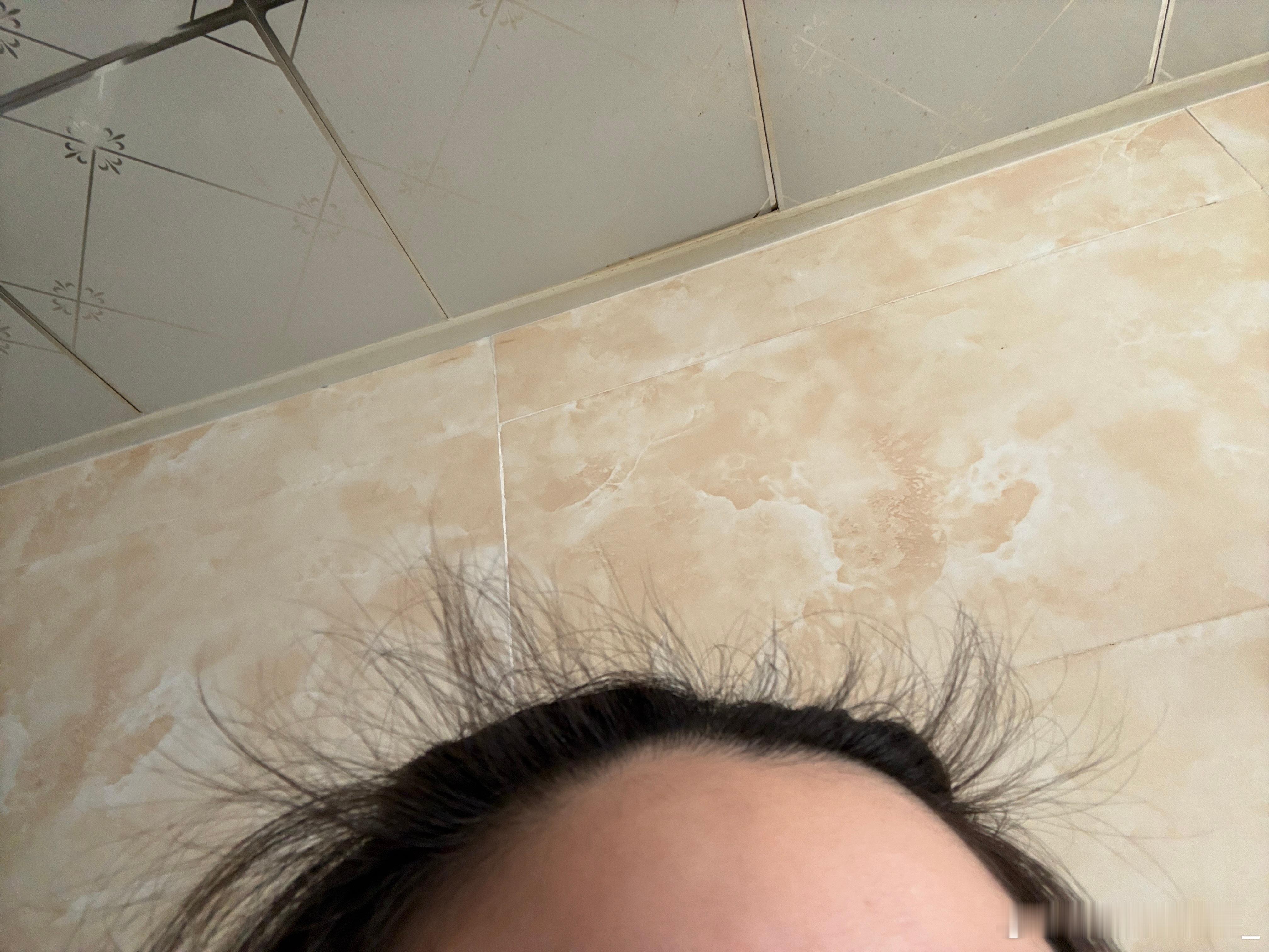 生发帽真的有用！！！！！！发际线长了好多小毛毛希望发缝也能多发点力