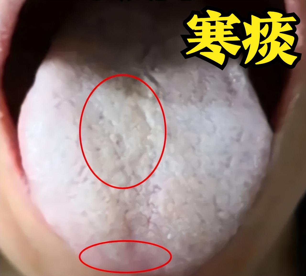 大家好，我是中医陈大夫！一到换季或受凉后，不少朋友就开始咳嗽、流清涕 —— 咳出