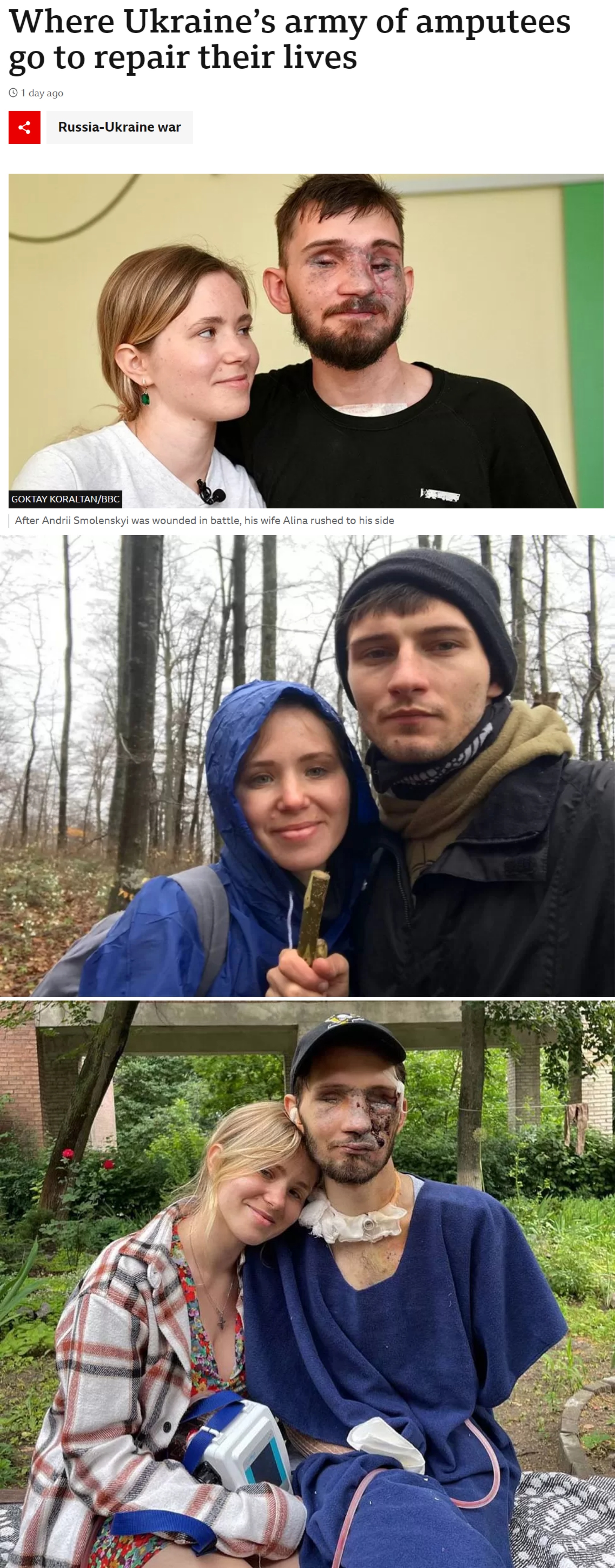 战争的极端残酷可见一斑！乌克兰基辅卫生部的数据说，仅2023年上半年约15,00